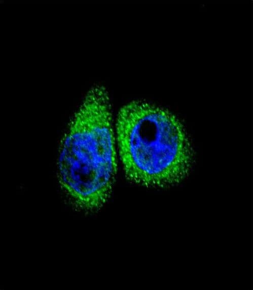 CYP7B1 Antibody (aa252-281)