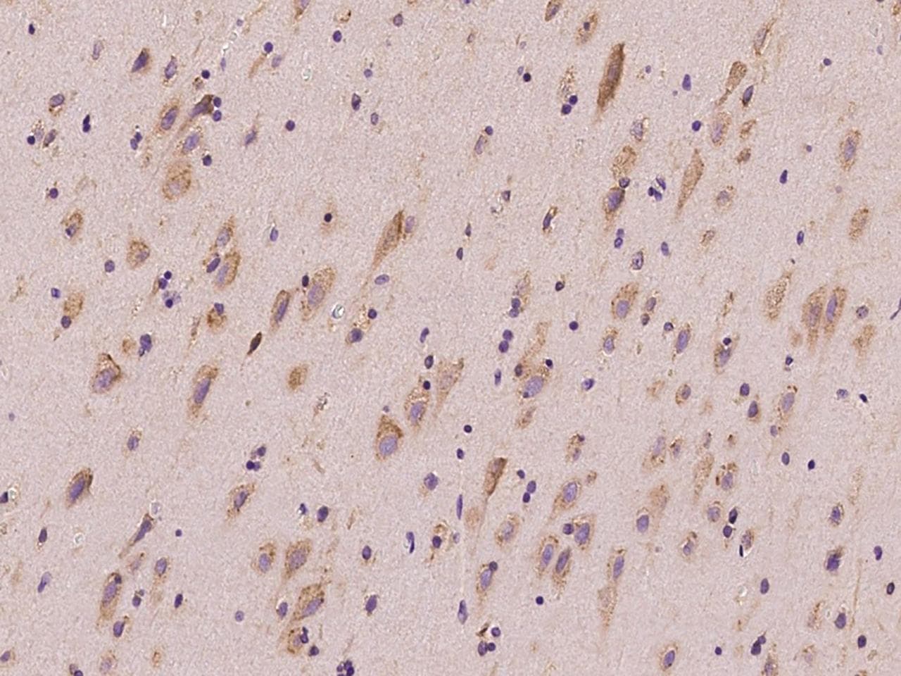 Polyclonal Rabbit anti-Human GLNRS / QARS Antibody (IHC, WB)