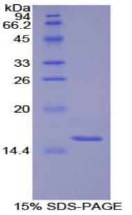 Human S100 Protein (Recombinant His-S)