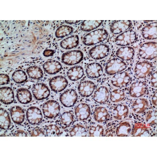 PTPRJ / CD148 Antibody (861-910 aa, Internal)
