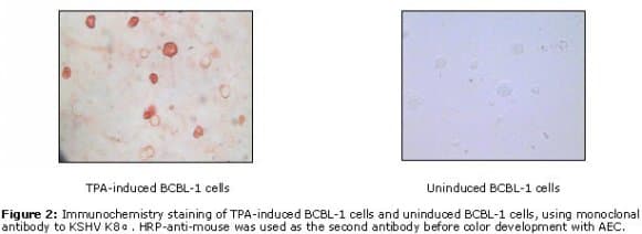 Monoclonal Mouse anti-Human Herpesvirus 8 HHV-8 K8 alpha Antibody (clone 8C12G10G1, IHC, WB)