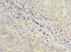 GDF5 / GDF-5 Antibody (aa202-501)