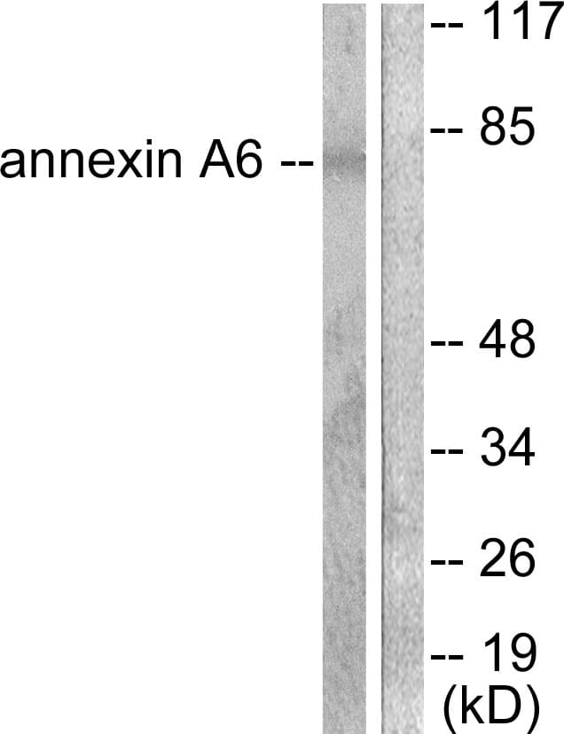 IHC-plus™ ANXA6/Annexin A6/Annexin VI Antibody (aa1-50)
