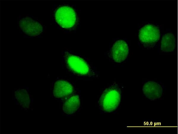 IHC-plus™ YAP / YAP1 Antibody (clone 2H1)