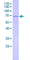 Human MYBPHL Protein (Recombinant GST, N-terminus)