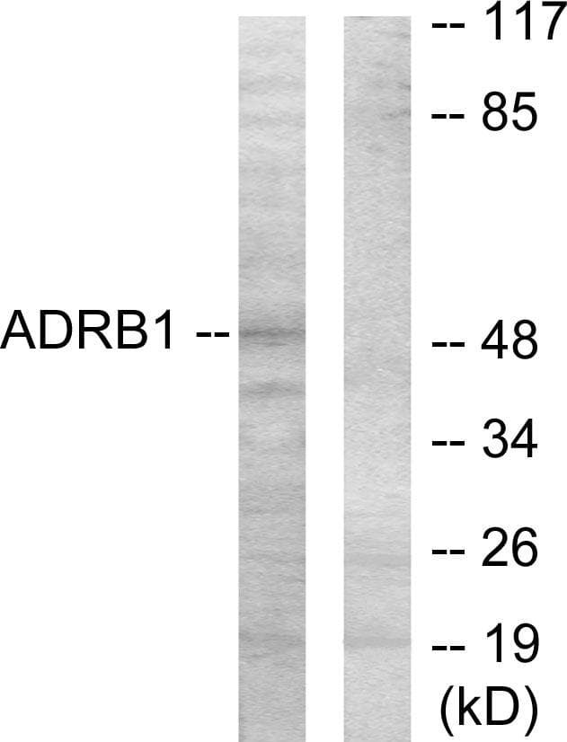 ADRB1 Antibody