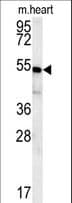 Polyclonal Rabbit anti-Human CHF1 / HEY2 Antibody (aa65-91, IHC, WB)