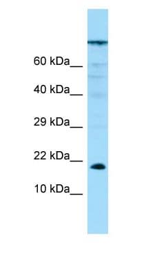 PPP1R14A / CPI-17 Antibody (aa7-56)