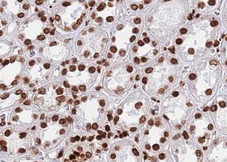 ZNF148 / ZBP-89 Antibody
