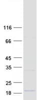 Human DEXI Protein (Recombinant Myc-DDK (Flag))