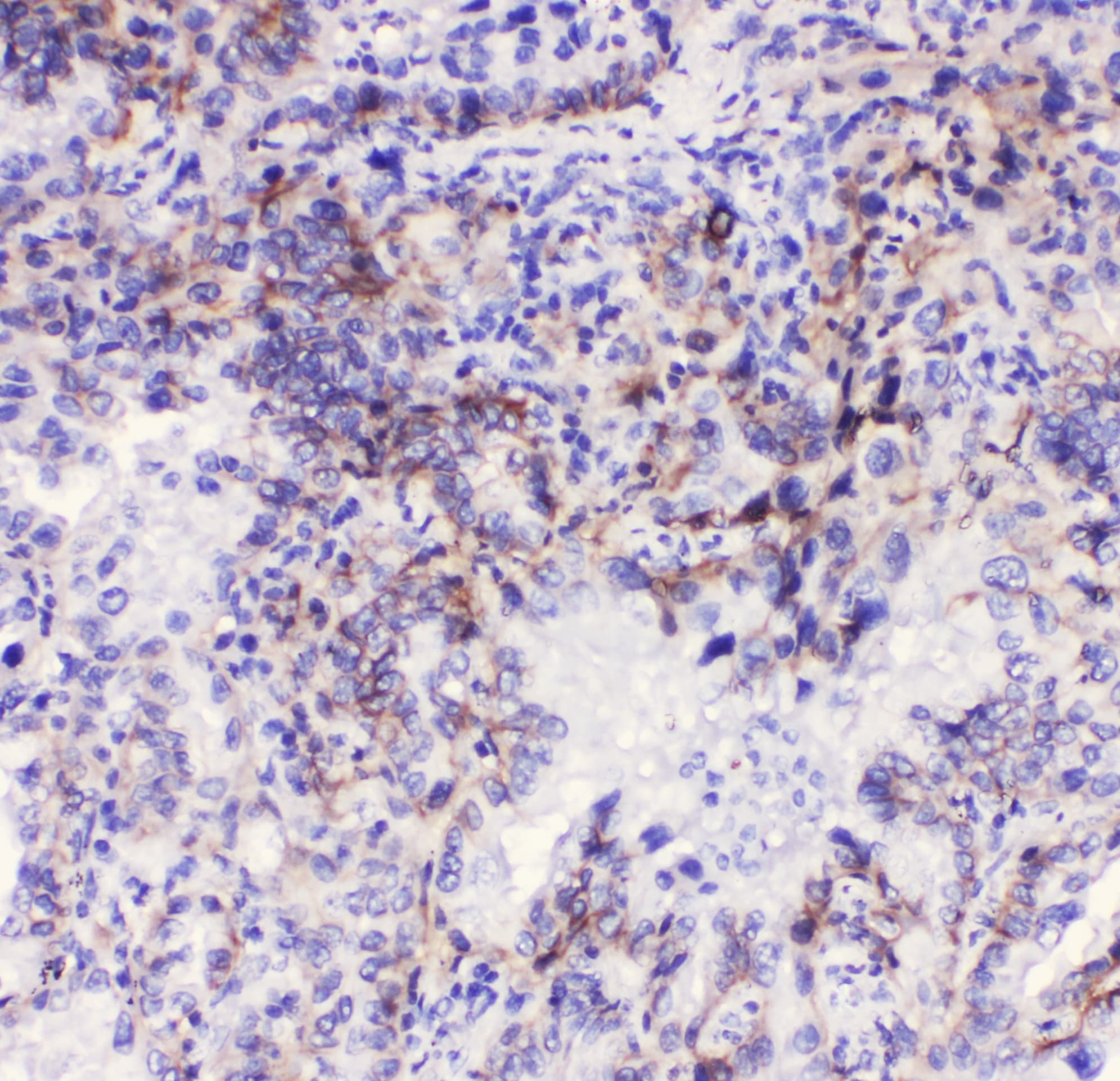Polyclonal Rabbit anti-Human ITGA3 / CD49c Antibody (IHC, WB)