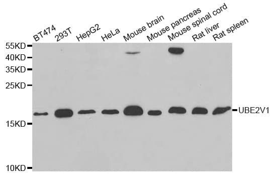 IHC-plus™ UEV1 / UEV1A Antibody