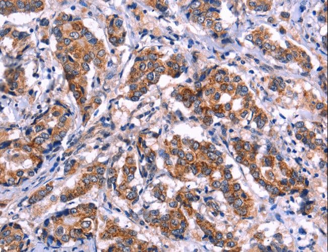 GCN2 Antibody