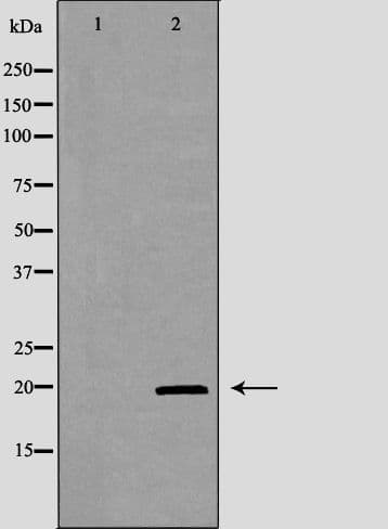 Polyclonal Rabbit anti-Human KLRD1 / CD94 Antibody (IHC, IF, WB)