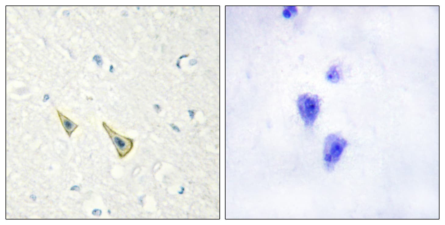 KCNIP3 / Dream / Calsenilin Antibody (phospho-Ser63)