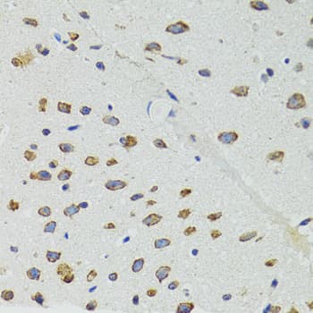 Polyclonal Rabbit anti-Human DICER1 / Dicer Antibody (IHC, WB)