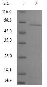 Human CNOT8 Protein (Recombinant GST, N-terminus)