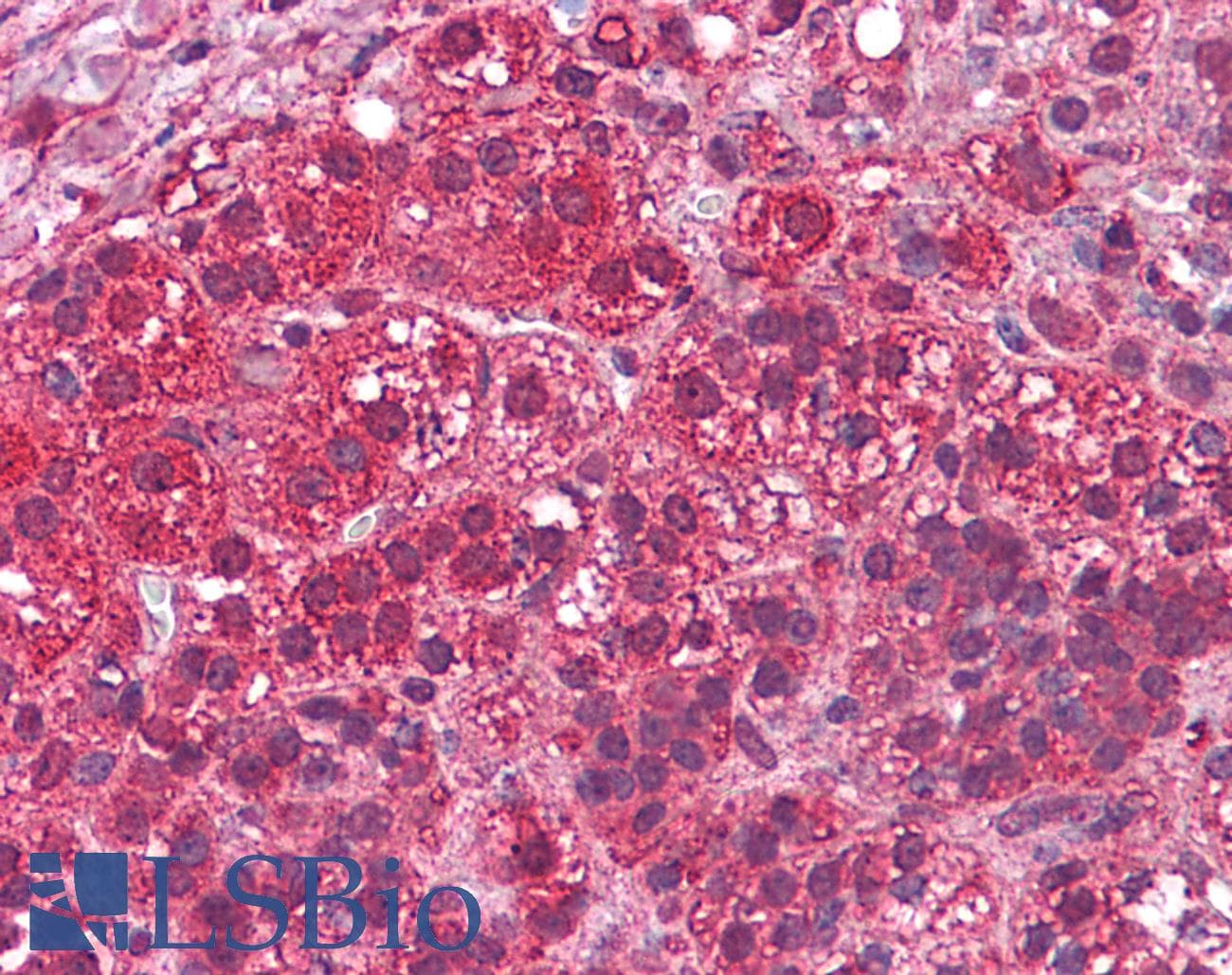IHC-plus™ Polyclonal Rabbit anti-Human C4.4A / LYPD3 Antibody (N-Terminus, IHC)