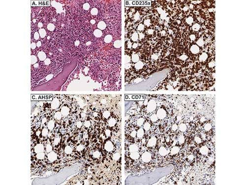 AHSP / EDRF Antibody (Liquid)