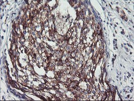 PPP1R15A / GADD34 Antibody (clone OTI1E1)