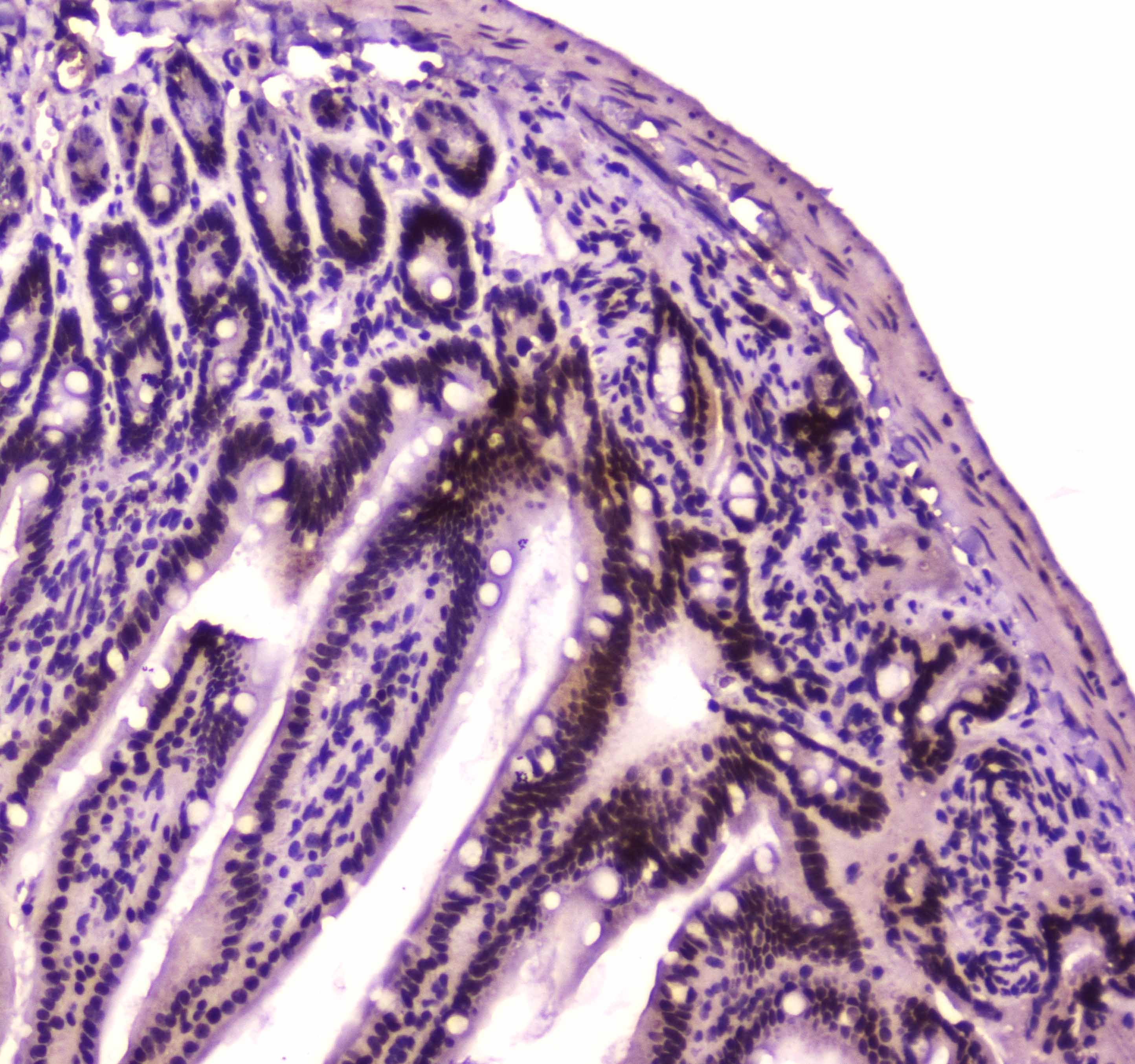 Polyclonal Rabbit anti-Human SMARCA4 / BRG1 Antibody (IHC, WB)