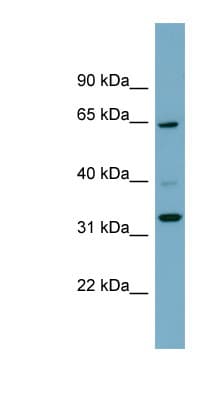 ZNF791 Antibody (aa35-84)