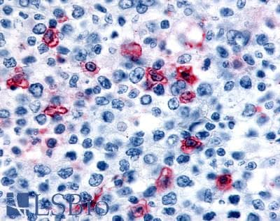 PathPlus™ HRH4 / Histamine H4 Receptor Antibody (Cytoplasmic Domain)