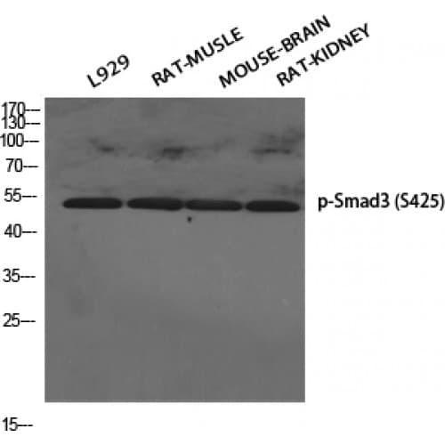 Polyclonal Rabbit anti-Human SMAD3 Antibody (350-430 aa, IHC, WB)