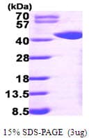 Human GALK1 / GK1 Protein (Recombinant His)