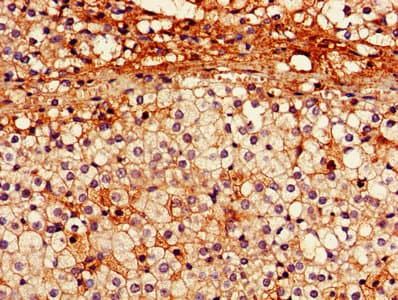 Polyclonal Rabbit anti-Human PARK2 / Parkin 2 Antibody (aa1-465)