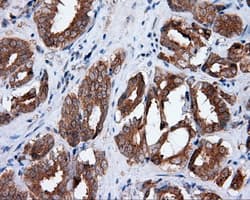 HMRF1L / MTRF1L Antibody (clone OTI1C5)