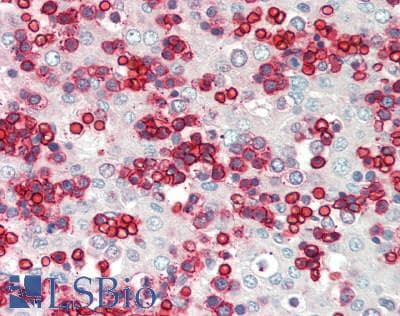 ERMAP / SC Antibody (aa324-373)