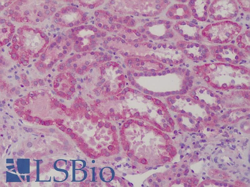 IHC-plus™ GSTM1 Antibody