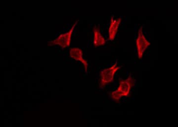 Polyclonal Rabbit anti-Human OR4D6 Antibody (IF, WB)
