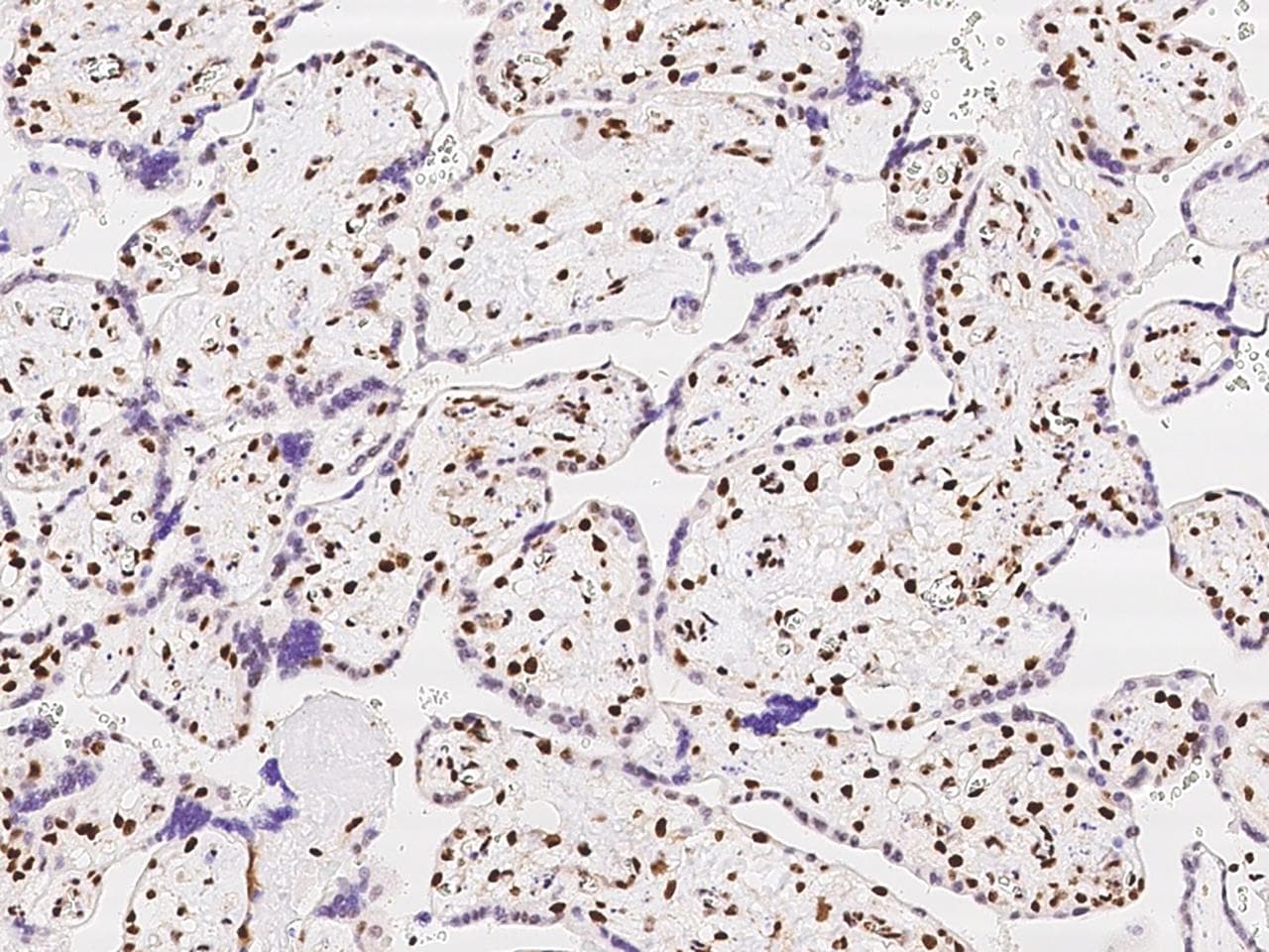 Polyclonal Rabbit anti-Human SP100 Antibody (IHC, IF)