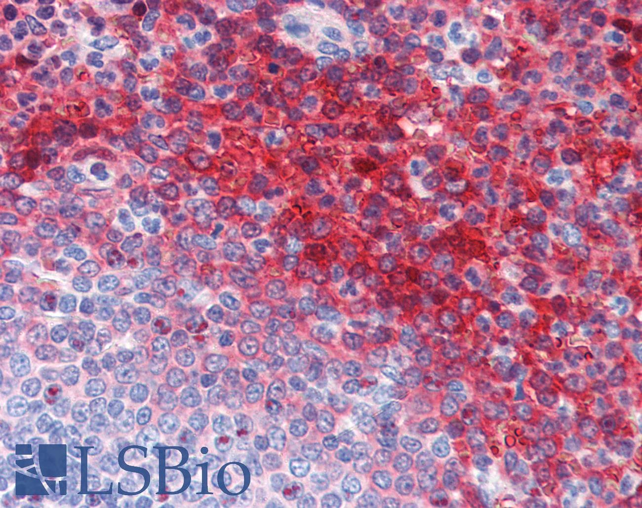 IHC-plus™ Monoclonal Mouse anti-Human CA1 / Carbonic Anhydrase I Antibody (clone 9D6D7, IHC, WB)