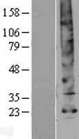 AQP5 / Aquaporin 5 Protein (Over-Expression Lysate Myc-DDK (Flag))