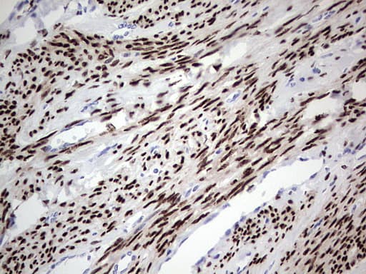 PR / Progesterone Receptor Antibody (aa1-298, clone OTI34G6)