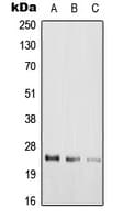 RAB39 / RAB39A Antibody (Internal)