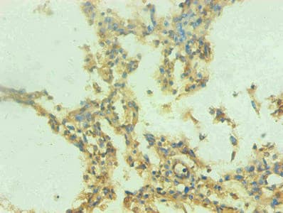 Monoclonal Mouse anti-Human S100A9 / MRP14 Antibody (clone 1G1C1, IHC)