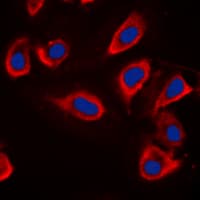 ADD1 / Adducin Alpha Antibody (Internal)