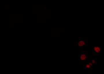 PBOV1 Antibody