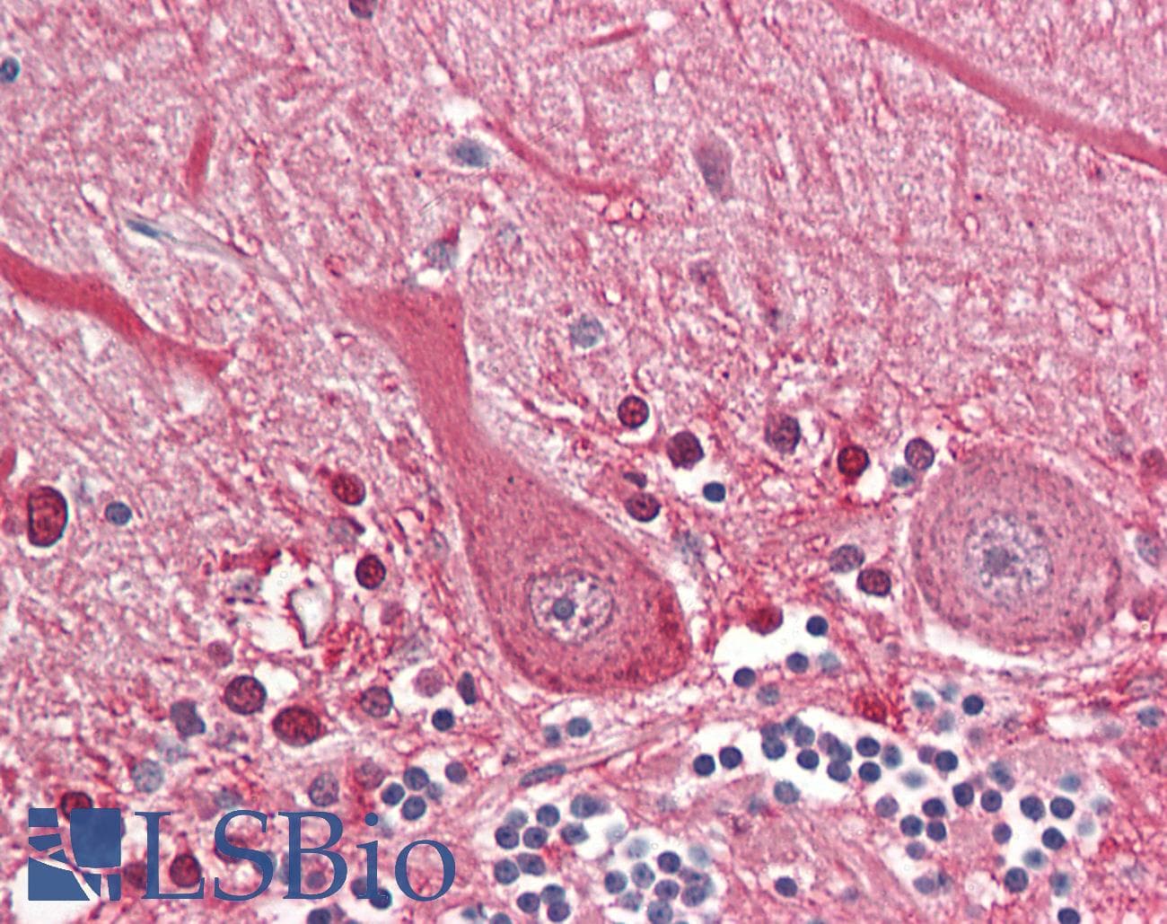 IHC-plus™ SEPT4 / Septin 4 Antibody (aa440-450)