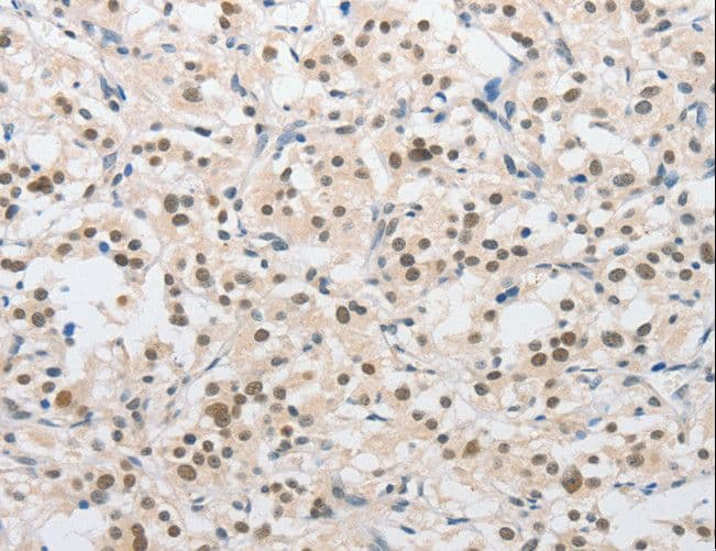 Polyclonal Rabbit anti-Human SAE1 Antibody (IHC, WB)