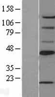 Human SCD1 / SCD Protein (Over-Expression Lysate Myc-DDK (Flag))