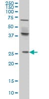 PRELID1 Antibody (clone 7B4)