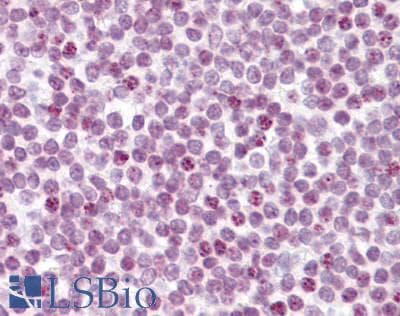 IHC-plus™ RBL2 / RB2 p130 Antibody (aa175-189)