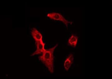 Polyclonal Rabbit anti-Human SFRP2 Antibody (IF, WB)
