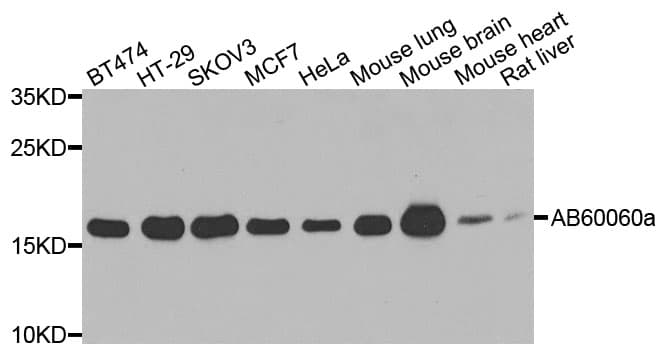 Polyclonal Rabbit anti-Human ARF1 Antibody (IHC, WB)