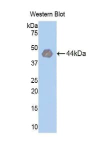 HK1 / Hexokinase 1 Antibody (aa413-540)